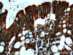MICA Antibody in Immunohistochemistry (Paraffin) (IHC (P))