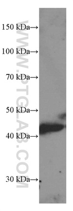 MICA Antibody in Western Blot (WB)