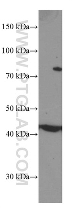 MICA Antibody in Western Blot (WB)
