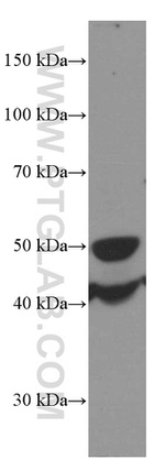 MICA Antibody in Western Blot (WB)