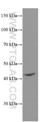 MICA Antibody in Western Blot (WB)
