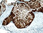 PADI2 Antibody in Immunohistochemistry (Paraffin) (IHC (P))