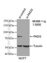 PADI2 Antibody in Western Blot (WB)