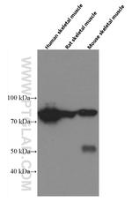 PADI2 Antibody in Western Blot (WB)