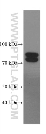 PADI2 Antibody in Western Blot (WB)