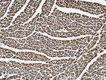 VDAC2 Antibody in Immunohistochemistry (Paraffin) (IHC (P))