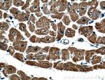 VDAC2 Antibody in Immunohistochemistry (Paraffin) (IHC (P))