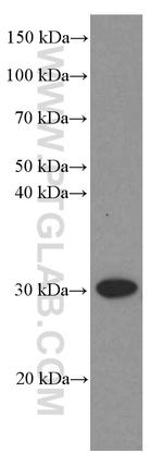 VDAC2 Antibody in Western Blot (WB)