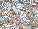 VDAC2 Antibody in Immunohistochemistry (Paraffin) (IHC (P))