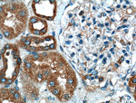 VDAC2 Antibody in Immunohistochemistry (Paraffin) (IHC (P))