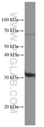 CD74 Antibody in Western Blot (WB)