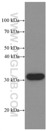 CD74 Antibody in Western Blot (WB)
