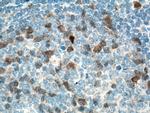 Cyclin A2 Antibody in Immunohistochemistry (Paraffin) (IHC (P))