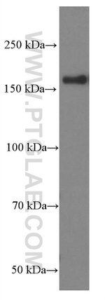 VPRBP Antibody in Western Blot (WB)