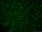 Calbindin-D28k Antibody in Immunohistochemistry (PFA fixed) (IHC (PFA))