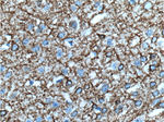 NF-M Antibody in Immunohistochemistry (Paraffin) (IHC (P))