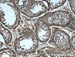 VTN Antibody in Immunohistochemistry (Paraffin) (IHC (P))