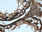 VTN Antibody in Immunohistochemistry (Paraffin) (IHC (P))