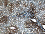 VTN Antibody in Immunohistochemistry (Paraffin) (IHC (P))