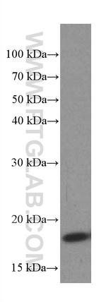 TPRKB Antibody in Western Blot (WB)