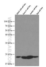 TPRKB Antibody in Western Blot (WB)