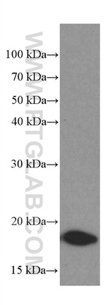 TPRKB Antibody in Western Blot (WB)