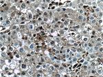 PSMB10 Antibody in Immunohistochemistry (Paraffin) (IHC (P))