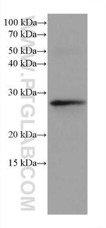PSMB10 Antibody in Western Blot (WB)
