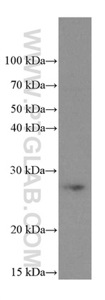 PSMB10 Antibody in Western Blot (WB)