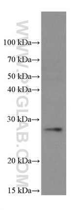 PSMB10 Antibody in Western Blot (WB)