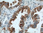 MSLN Antibody in Immunohistochemistry (Paraffin) (IHC (P))