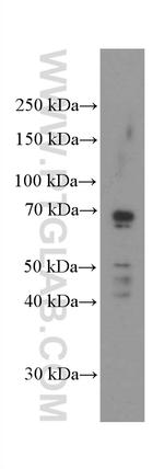 MSLN Antibody in Western Blot (WB)