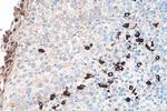 Heavy chain of IgG4 Antibody in Immunohistochemistry (Paraffin) (IHC (P))