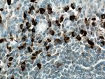 Heavy chain of IgG4 Antibody in Immunohistochemistry (Paraffin) (IHC (P))