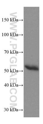 Heavy chain of IgG4 Antibody in Western Blot (WB)