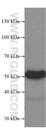 Heavy chain of IgG4 Antibody in Western Blot (WB)