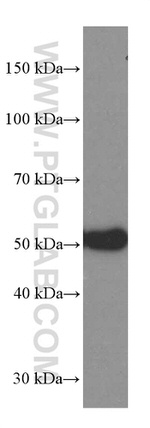 Heavy chain of IgG4 Antibody in Western Blot (WB)