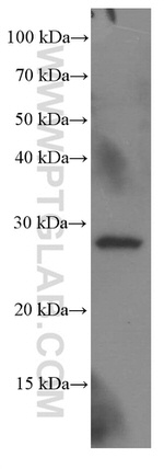 SCP3 Antibody in Western Blot (WB)