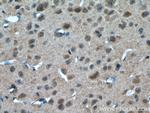 a-Synuclein Antibody in Immunohistochemistry (Paraffin) (IHC (P))
