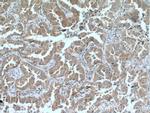 PKC alpha Antibody in Immunohistochemistry (Paraffin) (IHC (P))
