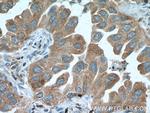 PKC alpha Antibody in Immunohistochemistry (Paraffin) (IHC (P))