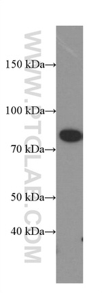 PKC alpha Antibody in Western Blot (WB)