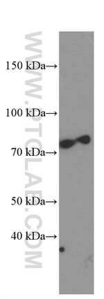 PKC alpha Antibody in Western Blot (WB)