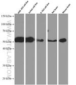 P2RX5 Antibody in Western Blot (WB)