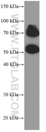 P2RX5 Antibody in Western Blot (WB)