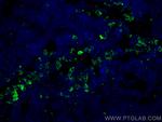 PLEK Antibody in Immunohistochemistry (PFA fixed) (IHC (PFA))