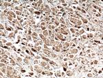 GDI1 Antibody in Immunohistochemistry (Paraffin) (IHC (P))