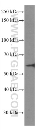 GDI1 Antibody in Western Blot (WB)