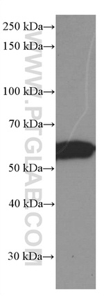 GDI1 Antibody in Western Blot (WB)