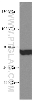 GNPAT Antibody in Western Blot (WB)
